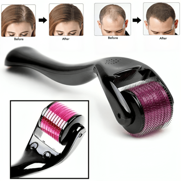 Derma Roller for Hair & Beard Growth - Image 5